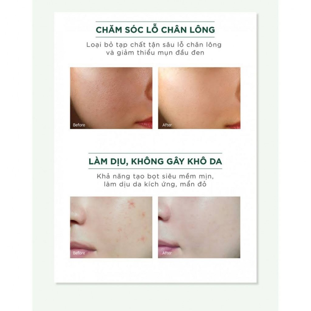 Sữa rửa mặt ngừa mụn Caryophy Portulaca 150ml