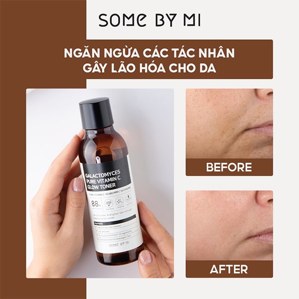 toner mờ thâm some by mi