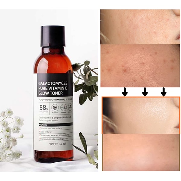 toner mờ thâm some by mi
